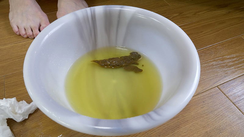 汚物フェチ大満足！キレイなお姉さんの脱糞・放尿・放屁をこれでもかってくらいに見まくれる！ | フェチの杜